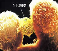 NK細胞療法