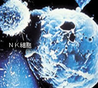 NK細胞