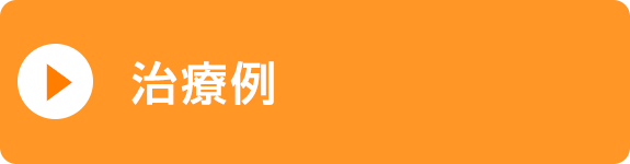 治療例