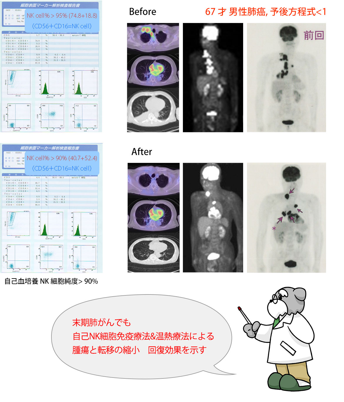 67才男性肺癌,予後方程式＜1