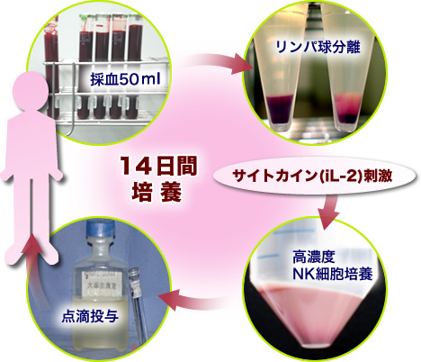 NK細胞療法による治療例