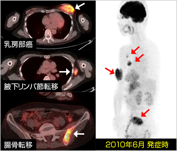 加療処置前（2010年6月）