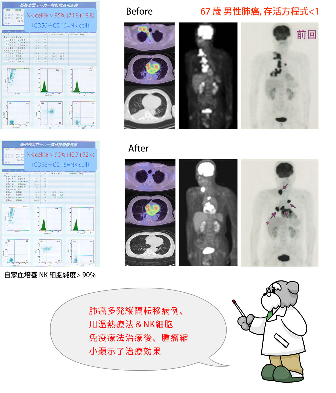 67歳男性肺癌, 存活方程式＜1