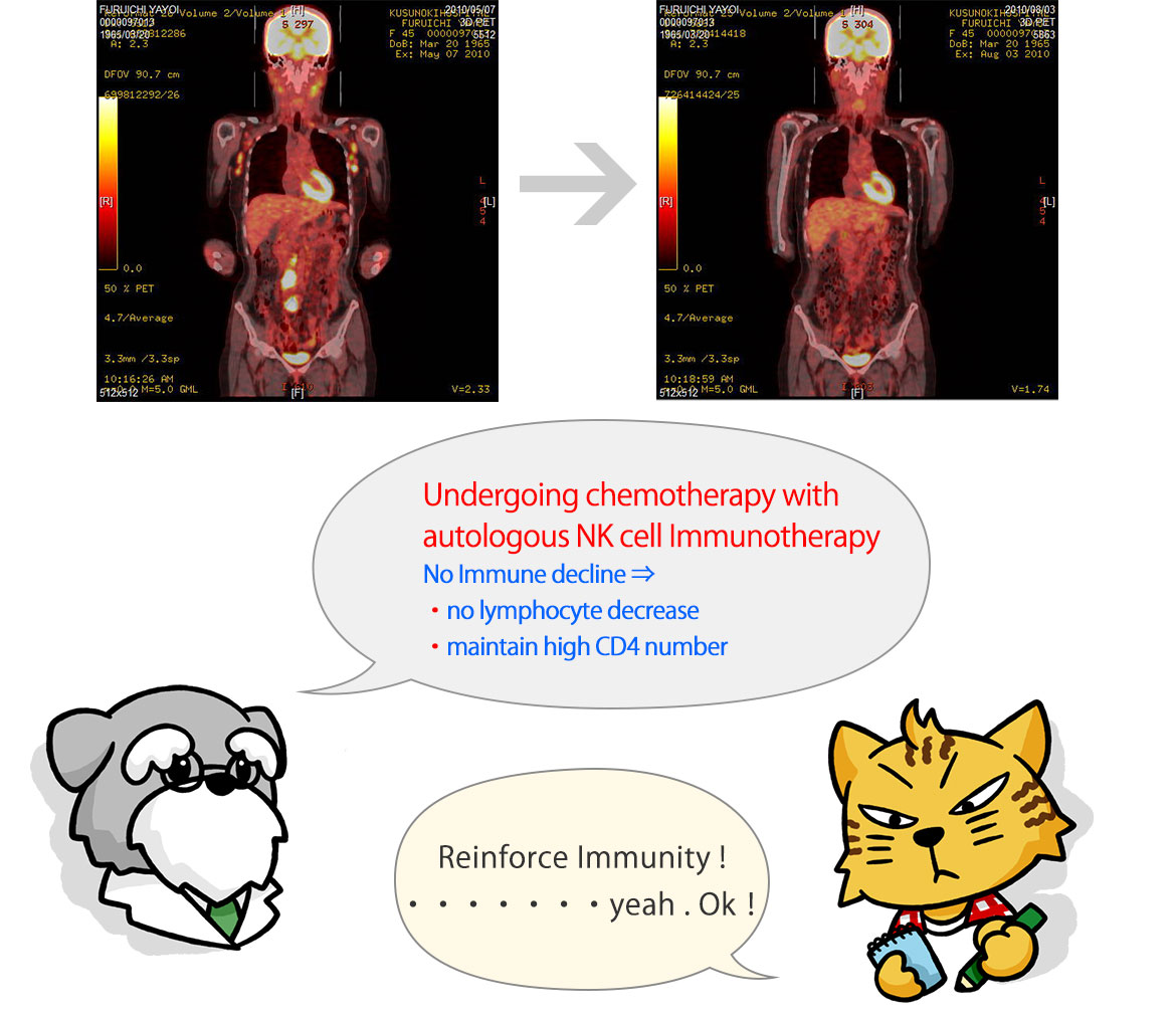 How does the NK Cell Immunotherapy  work in our immunity？