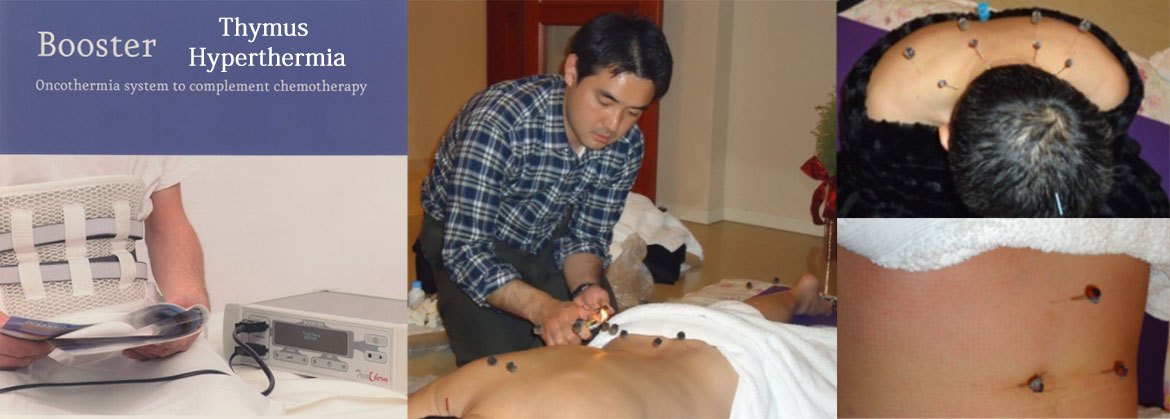 Immune-Hyperthermia(Thymus Hyperthermia) +Acupuncture