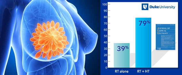 The  CR rate (local tumor control ) of Complete  Remission in Breast cancer