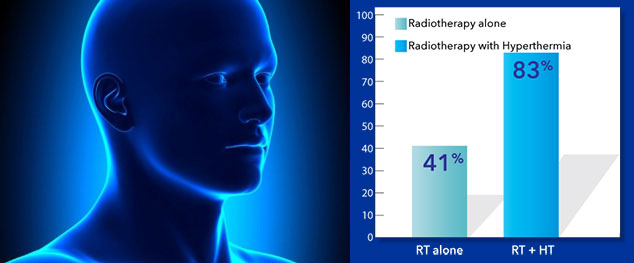 Complete Remission of Neck & Head cancer