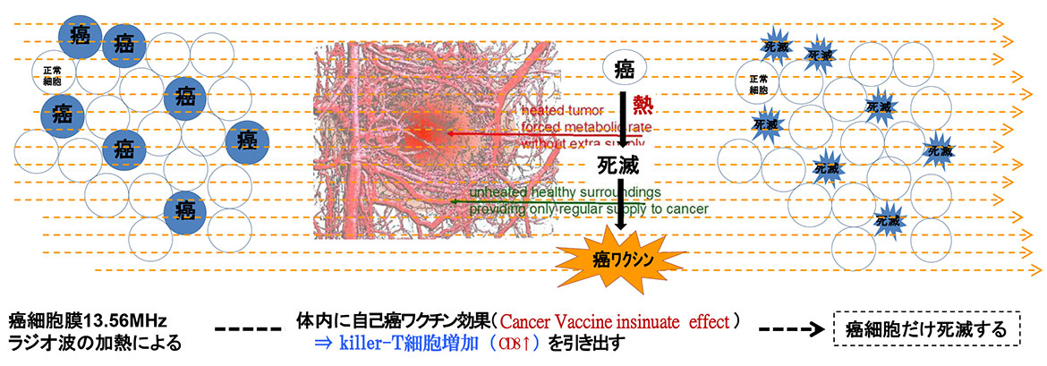 腫瘍温熱療法