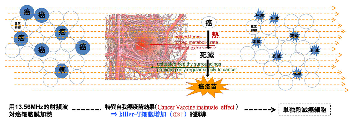 腫瘤温熱療法
