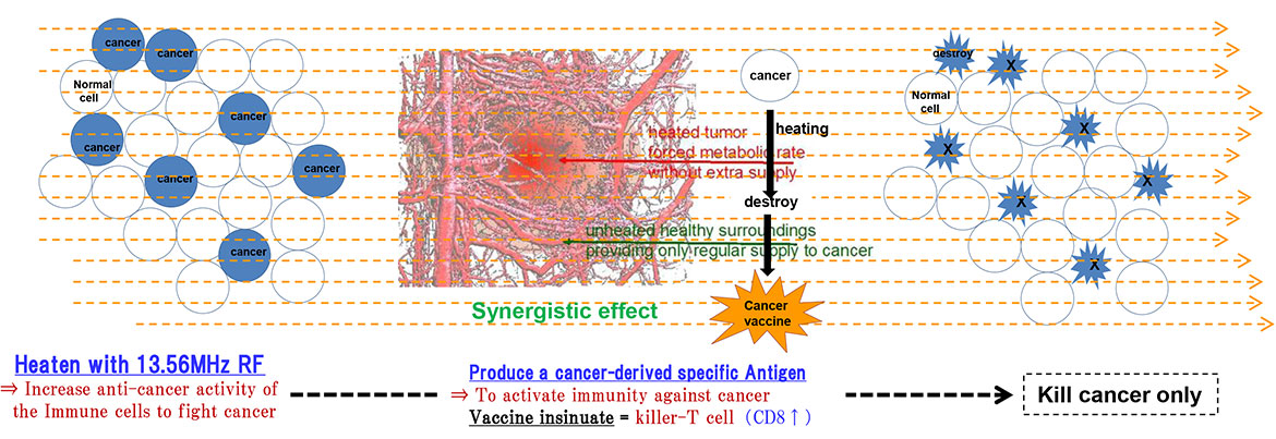Tumor Hyperthermia