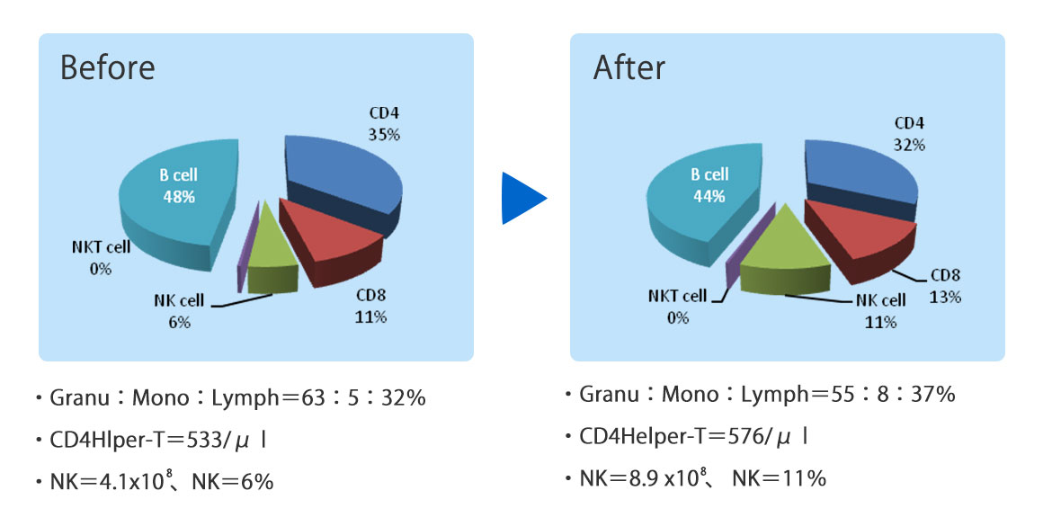 Immune-Hyperthermia(Thymus Hyperthermia) +Acupuncture